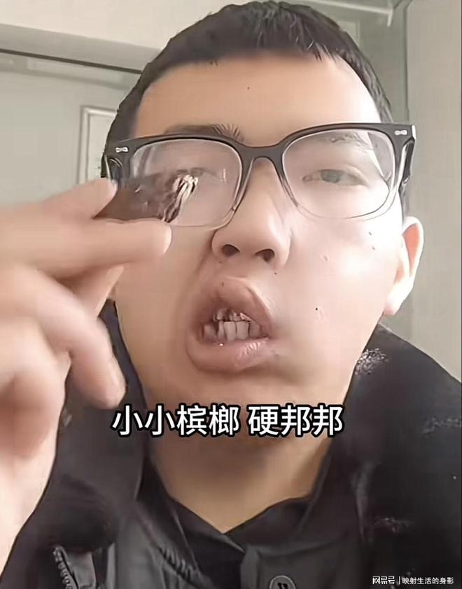 导致脸部变形还边嚼边劝大家别碰槟榔人生就是博-尊龙凯时男子嚼槟榔七年